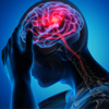 Dieses Bild zeigt eine digitale Abbildung eines menschlichen Gehirns einer Person, die sich an den Kopf fasst.