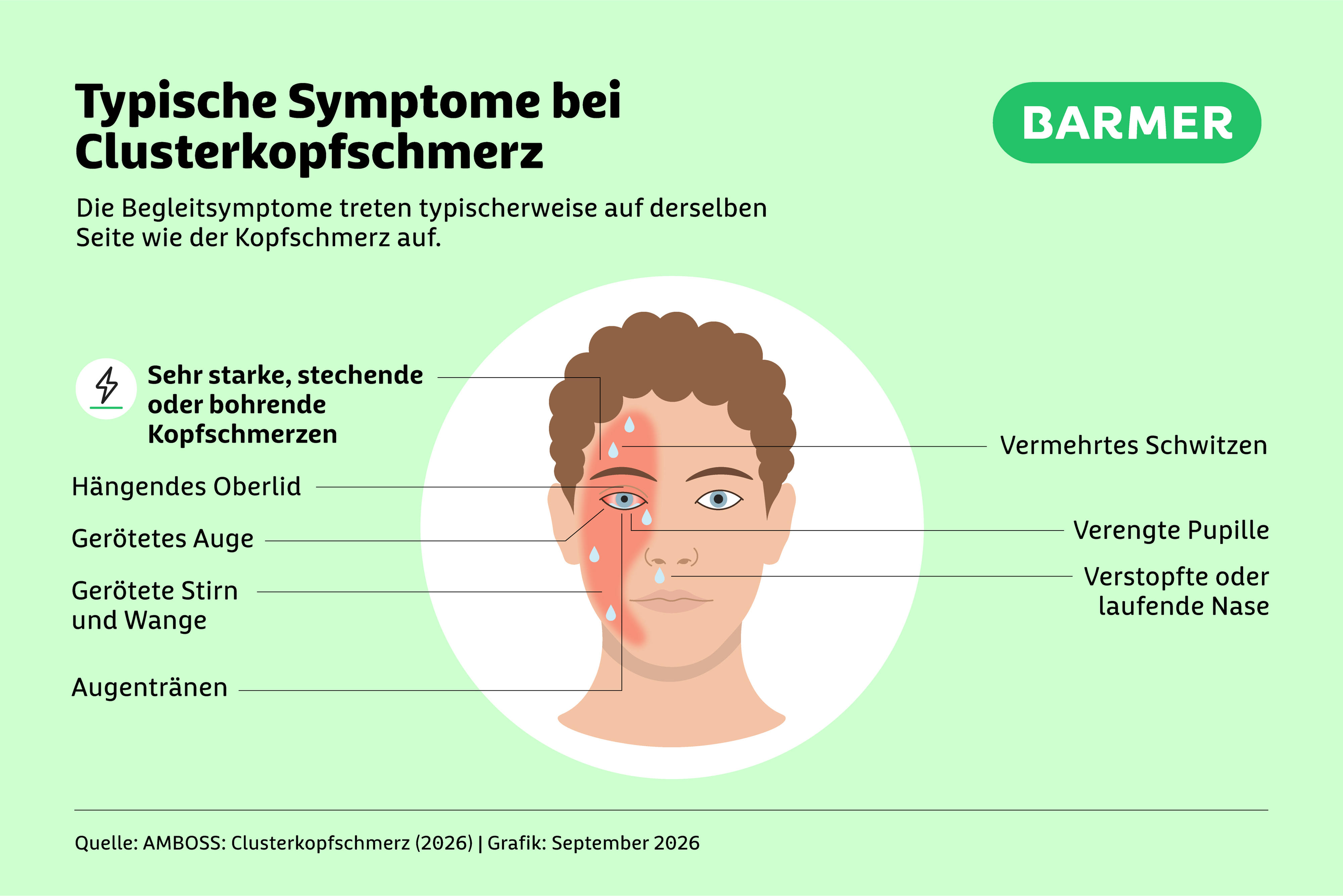 Infografik zeigt Symptome von Clusterkopfschmerzen: gerötetes, tränendes Auge, geschwollenes Augenlid, einseitige Augenschmerzen, vermehrtes Schwitzen, Licht- und Geräuschempfindlichkeit sowie verstopfte Nase