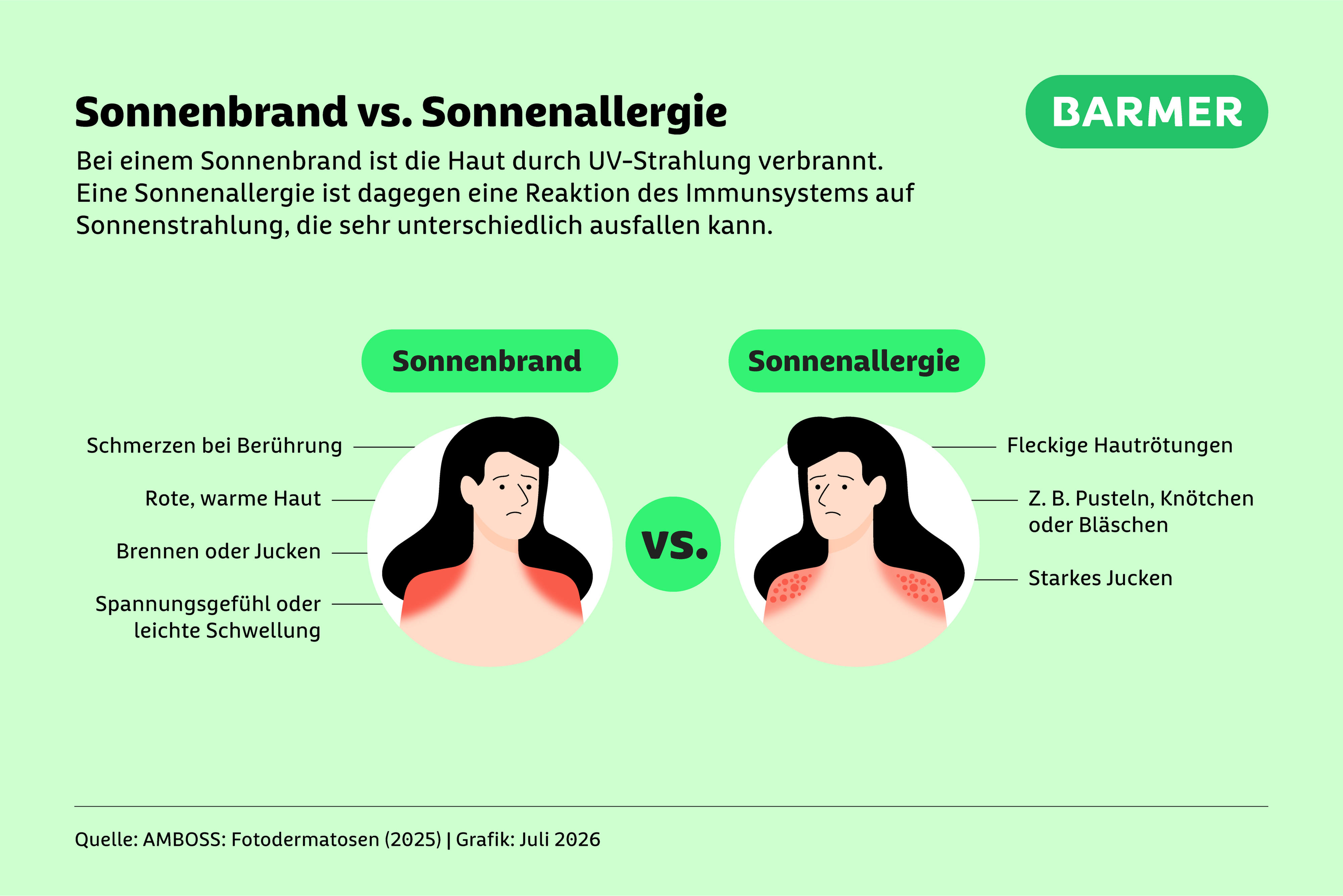 Ein Sonnenbrand entsteht, wenn UV-Strahlen die Haut schädigen. Eine Sonnenallergie ist dagegen eine Reaktion des Immunsystems auf Sonnenlicht.