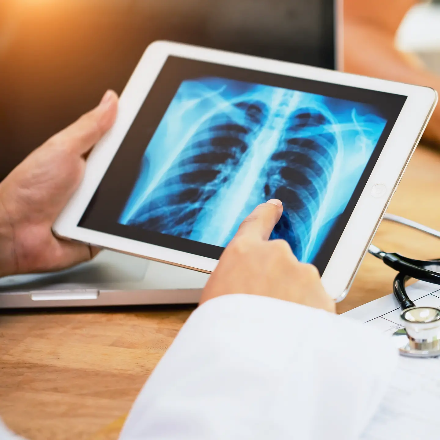 Ärzte betrachten eine Röntgen-Aufnahme einer Lunge