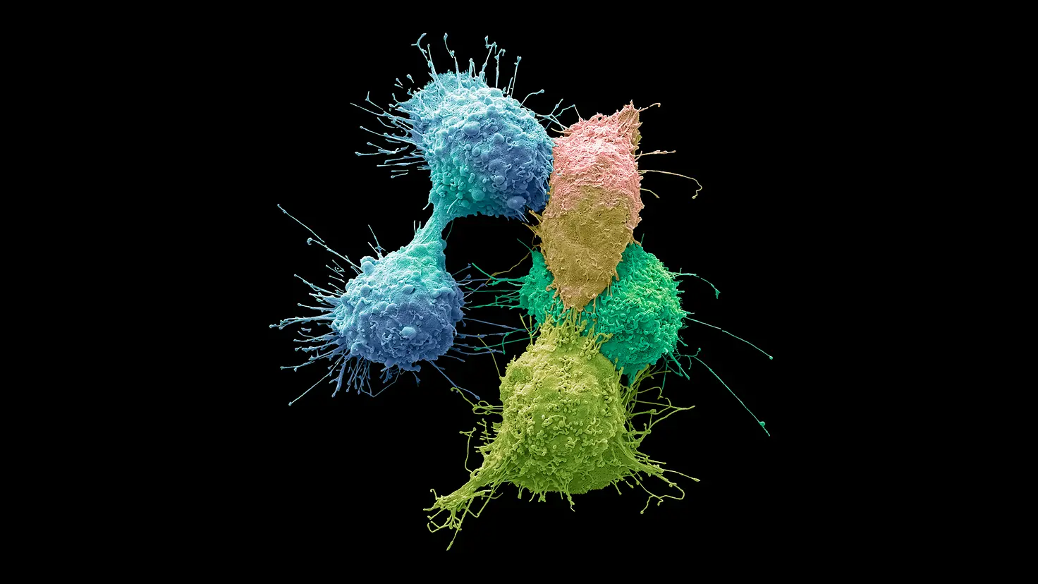 Stilisierte Darstellung einer Eierstockkrebs-Zelle