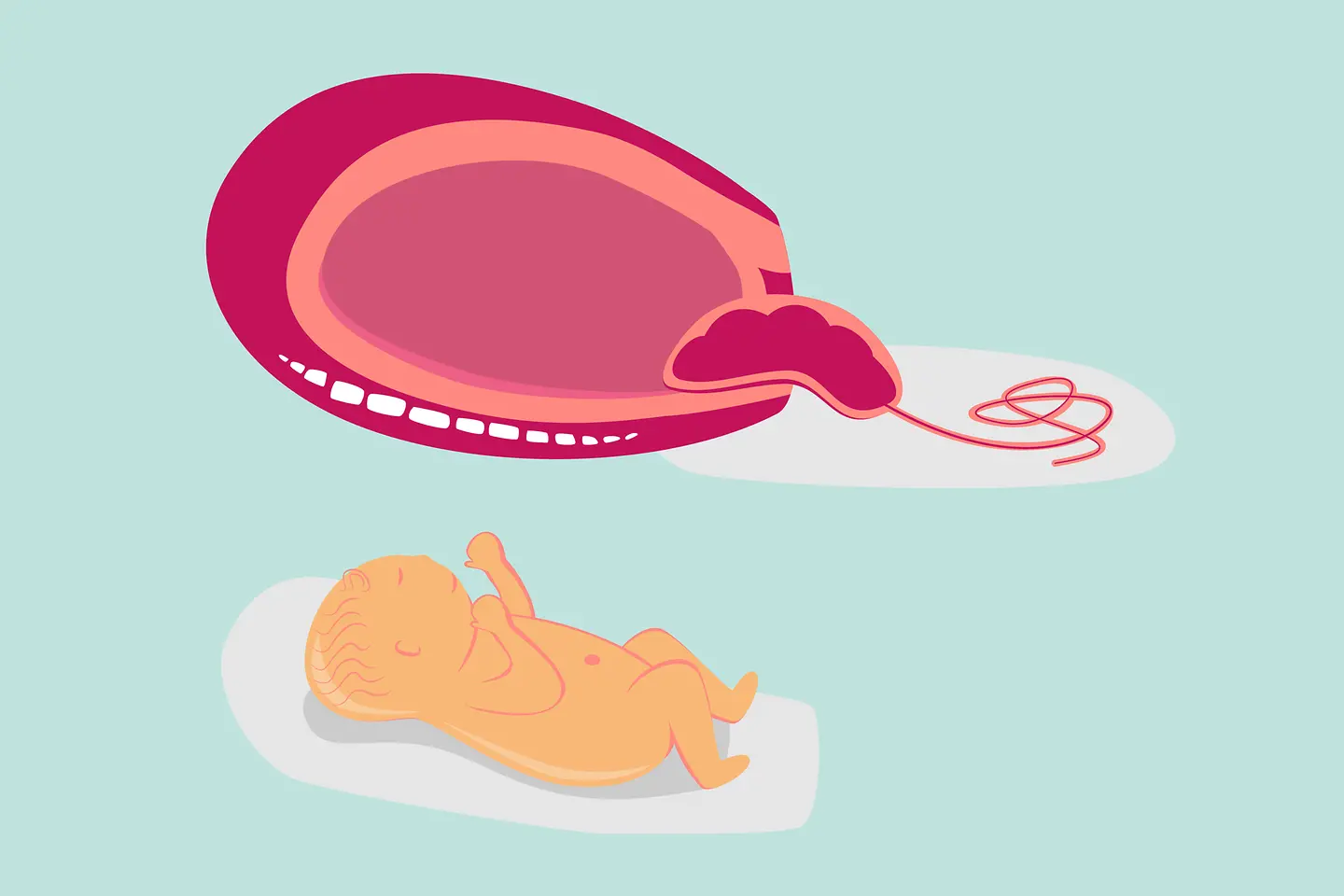 Illustration Nachgeburtsphase der Geburt: Die Nachgeburt wird ausgestoßen.