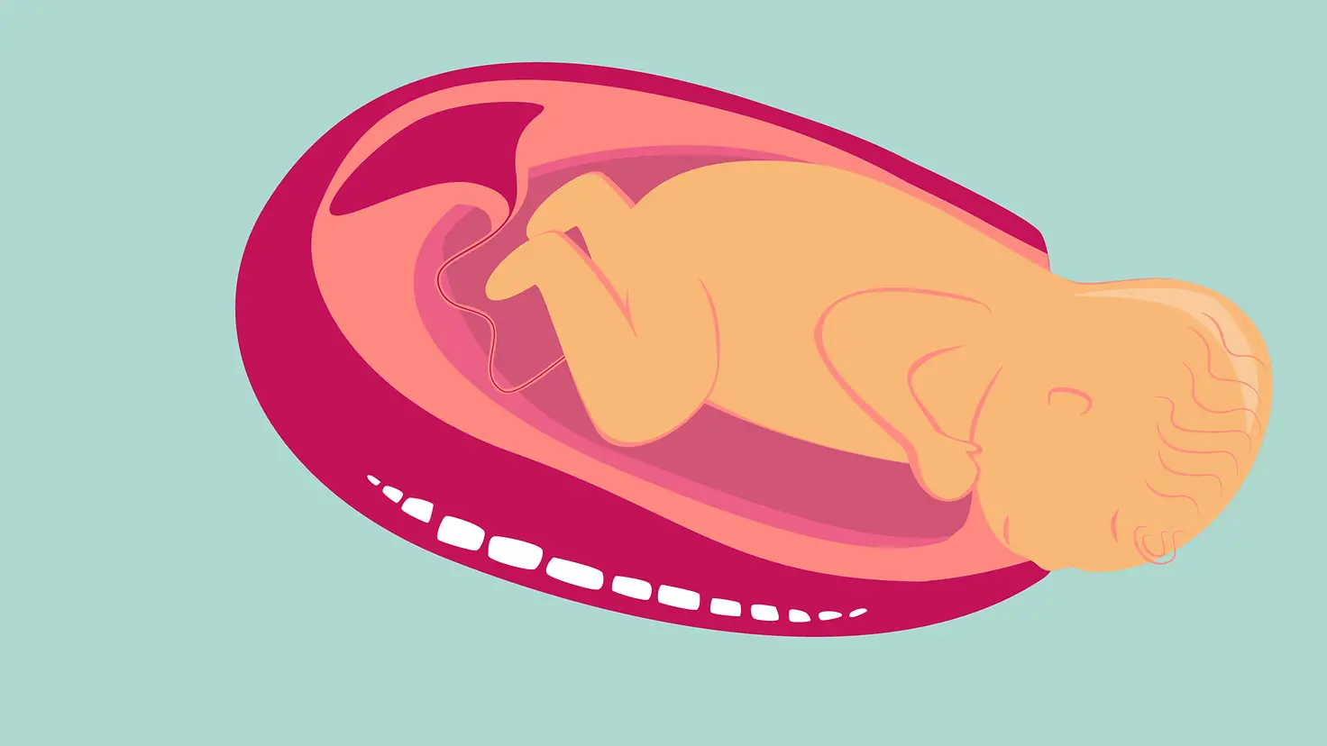 Illustration Austreibunsphase der Geburt: Zuerst wird das Köpfchen geboren.
