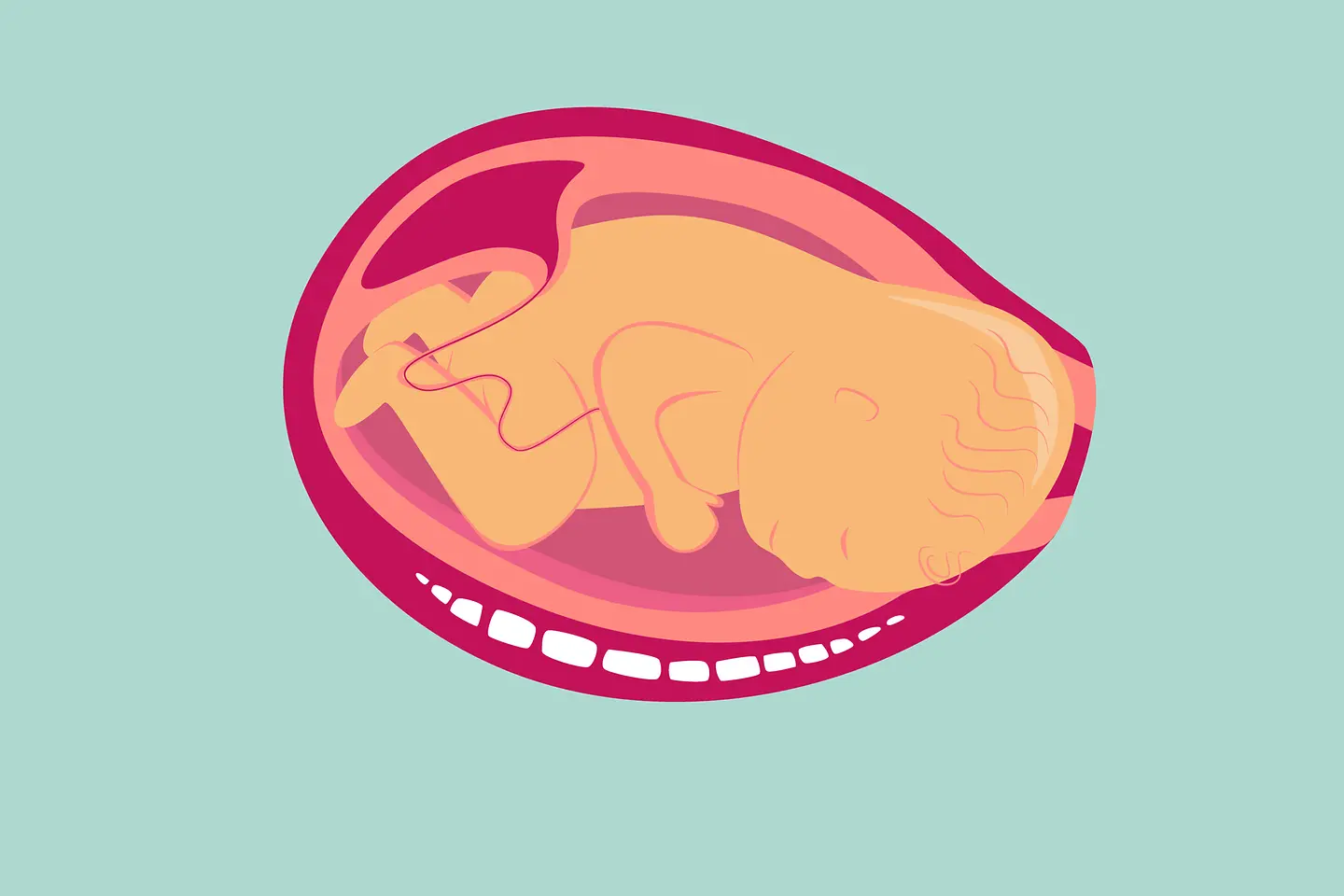 Illustration Übergangsphase der Geburt: Das Baby dreht sich mit dem Gesicht nach hinten.