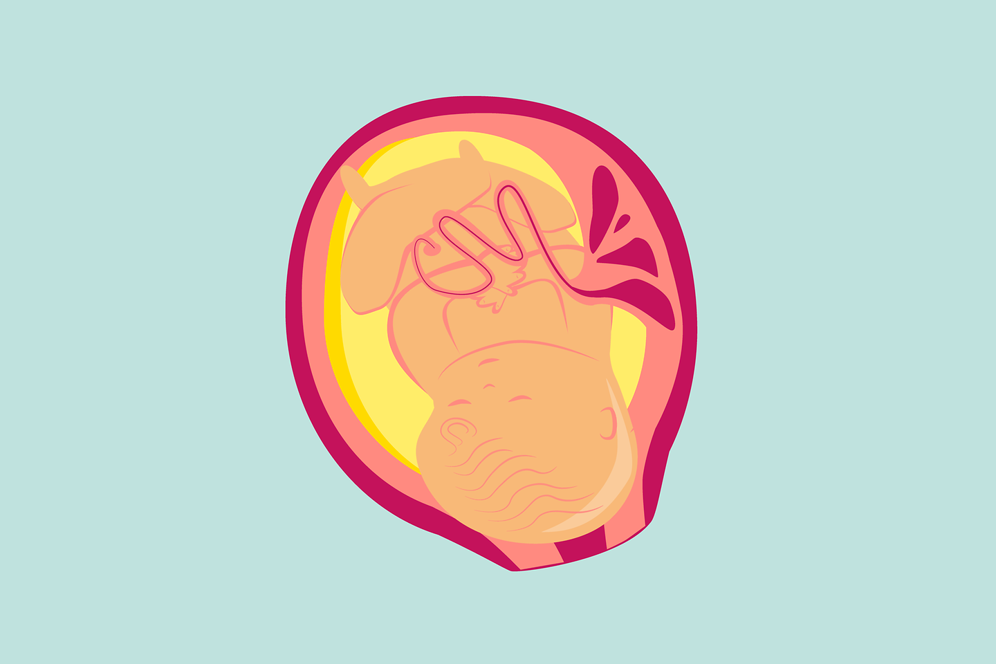 Illustration 10. Schwangerschaftsmonat: Das Baby liegt optimalerweise in Geburtsposition.