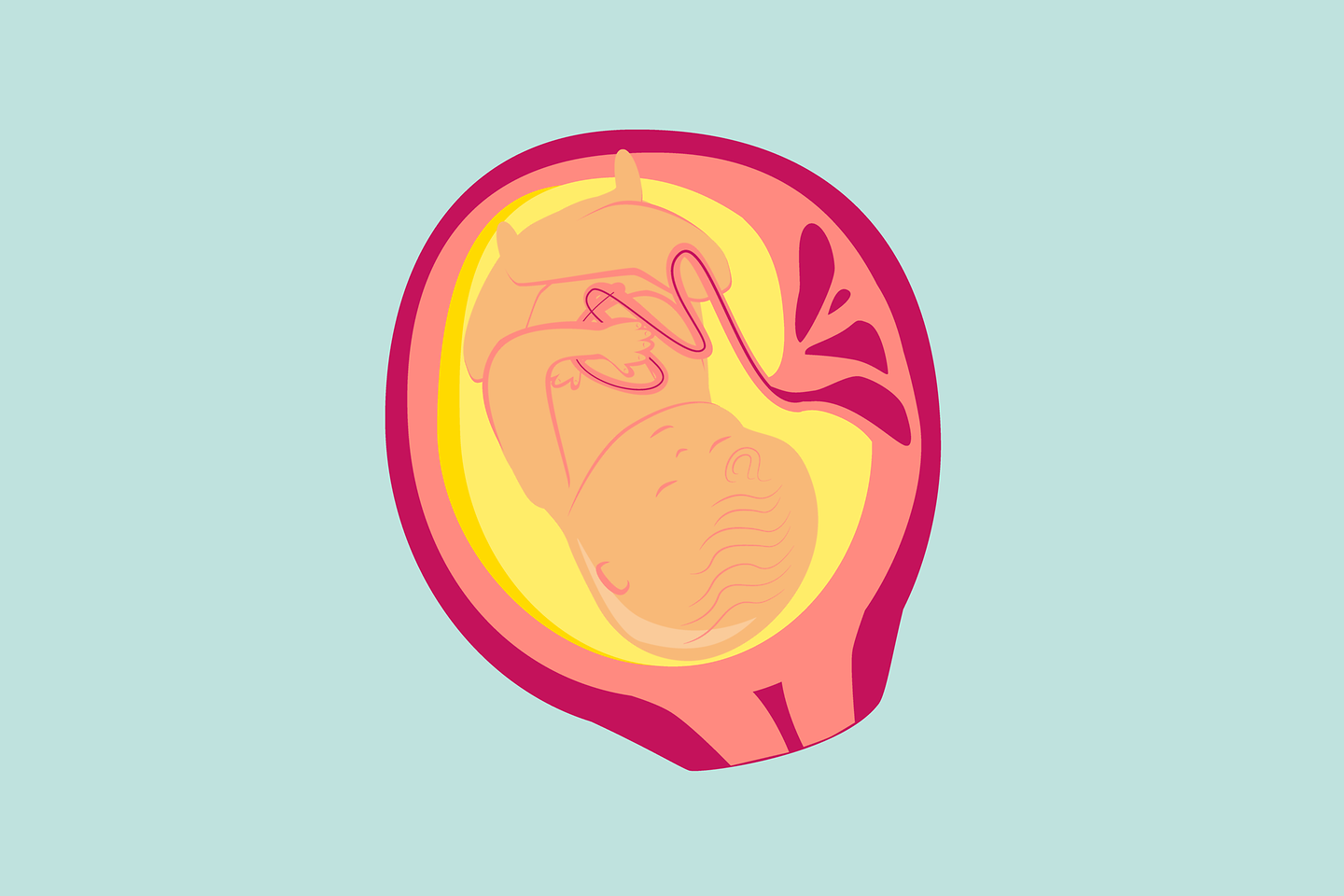 Illustration 9. Schwangerschaftsmonat: Die meisten Kinder drehen sich nun mit dem Kopf nach unten.