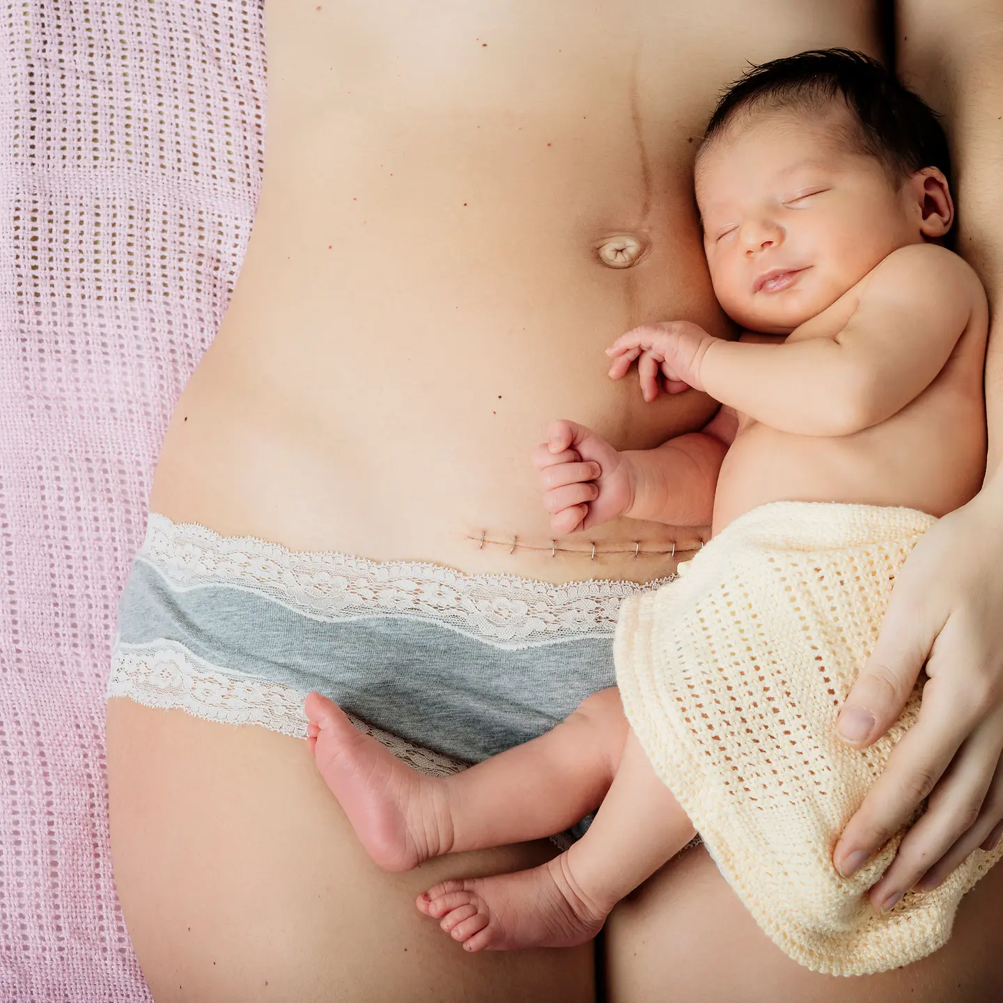 Junge Frau hält nach einem Kaiserschnitt ihr neugeborenes im Arm