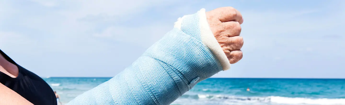 Eine Frau mit gebrochenen Hand am Strand