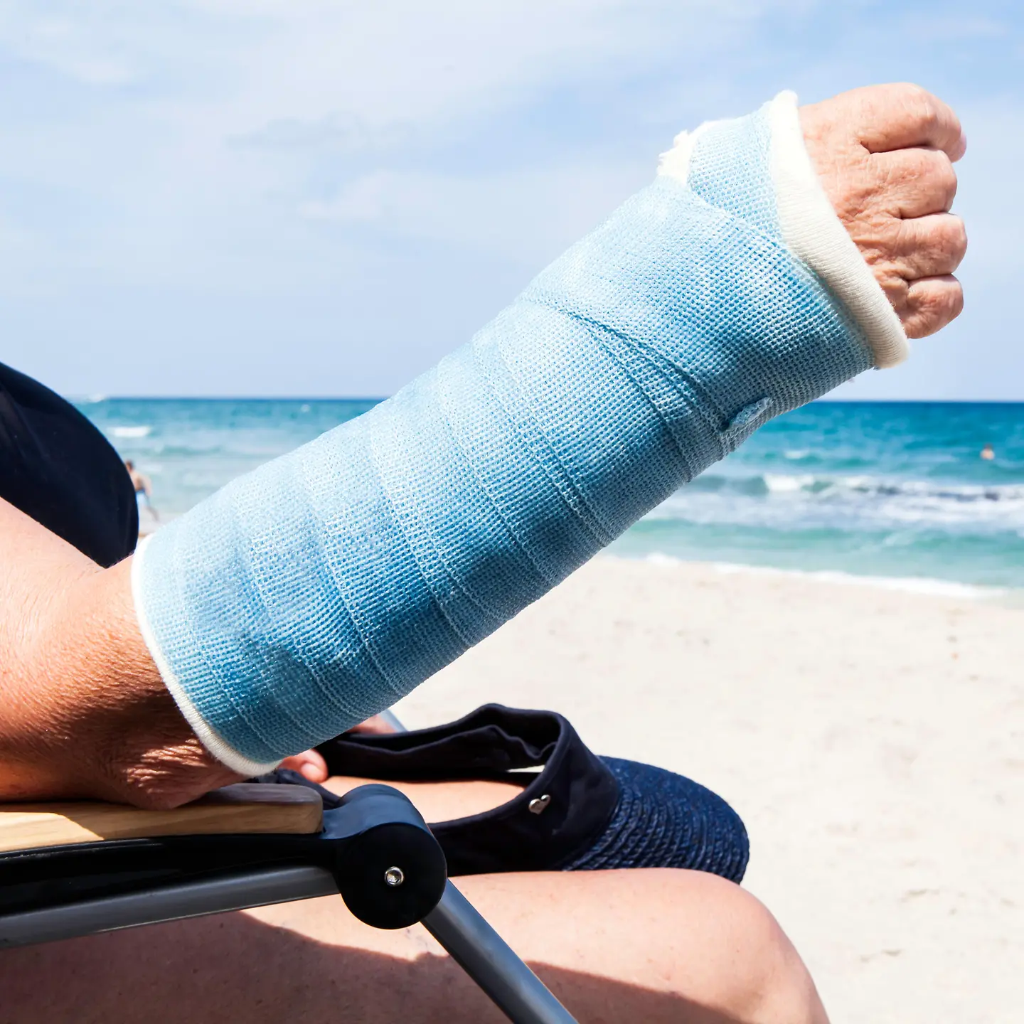 Eine Frau mit gebrochenen Hand am Strand