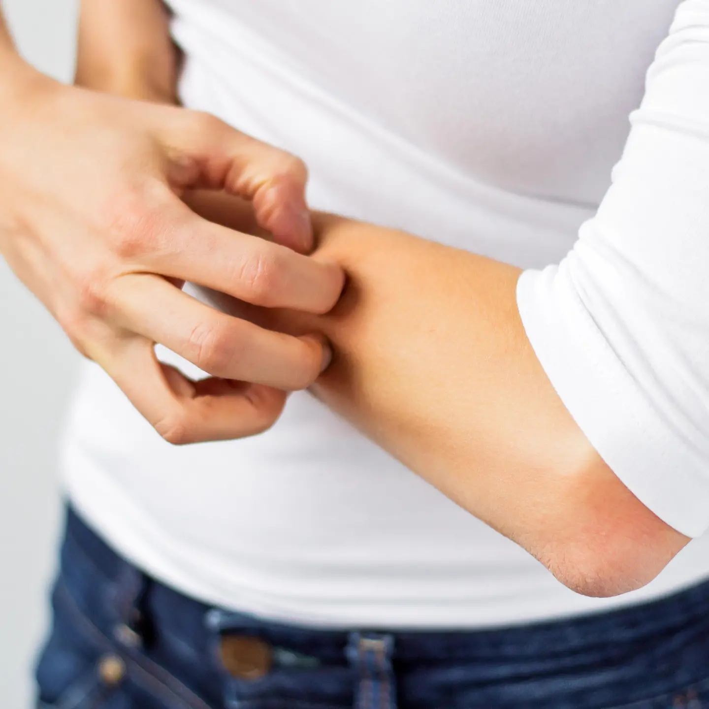 Frau kratzt sich am Unterarm