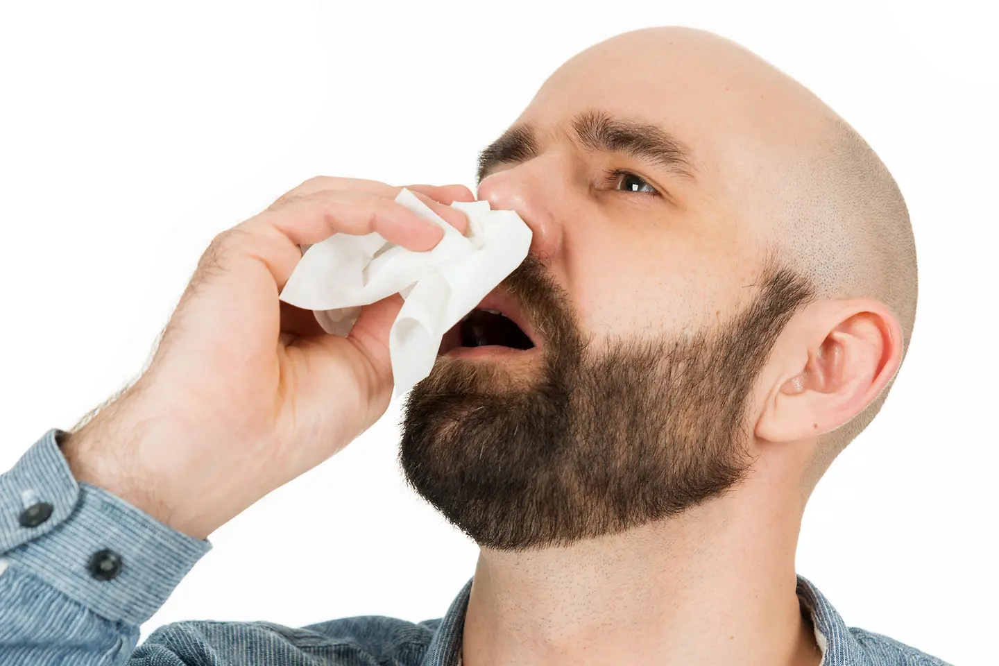 Das Bild zeigt einen Mann, der Nasenbluten hat und den Kopf in den Nacken legt.