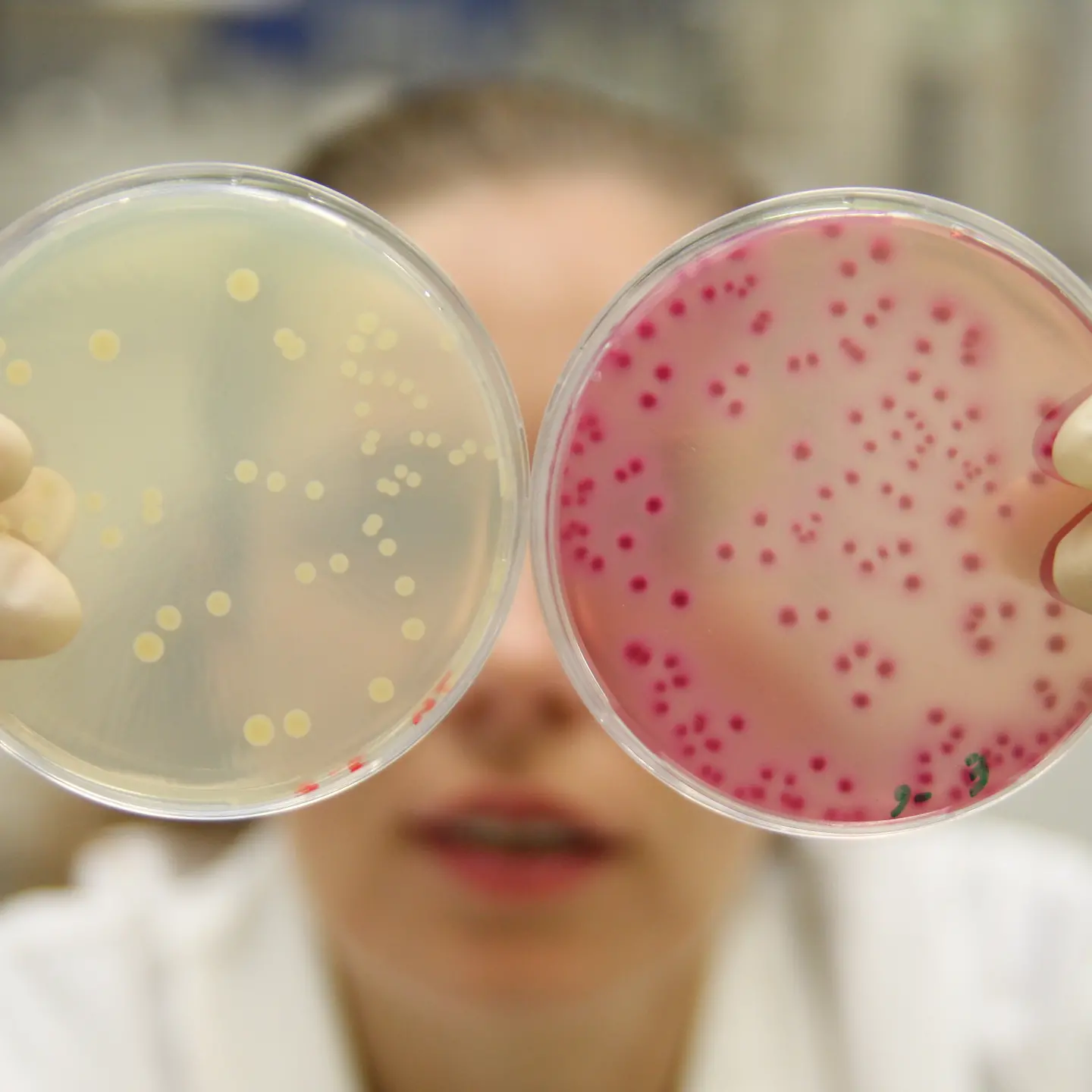 Eine weibliche Person im weißen Kittel schaut in zwei Petrischalen mit unterschiedlich gefärbten Inhalt.