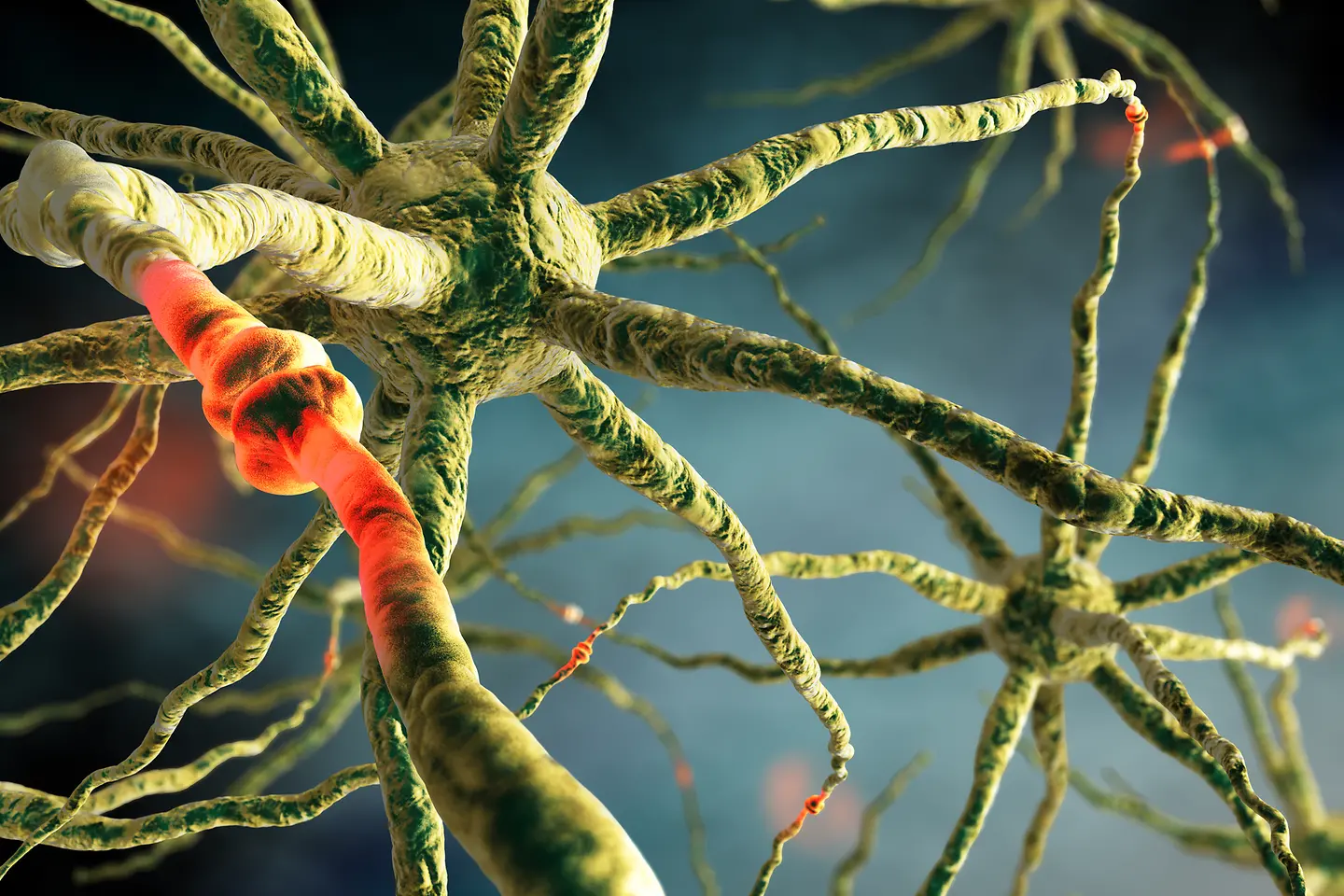 Darstellung einer Nervenzelle, auch Neuron genannt