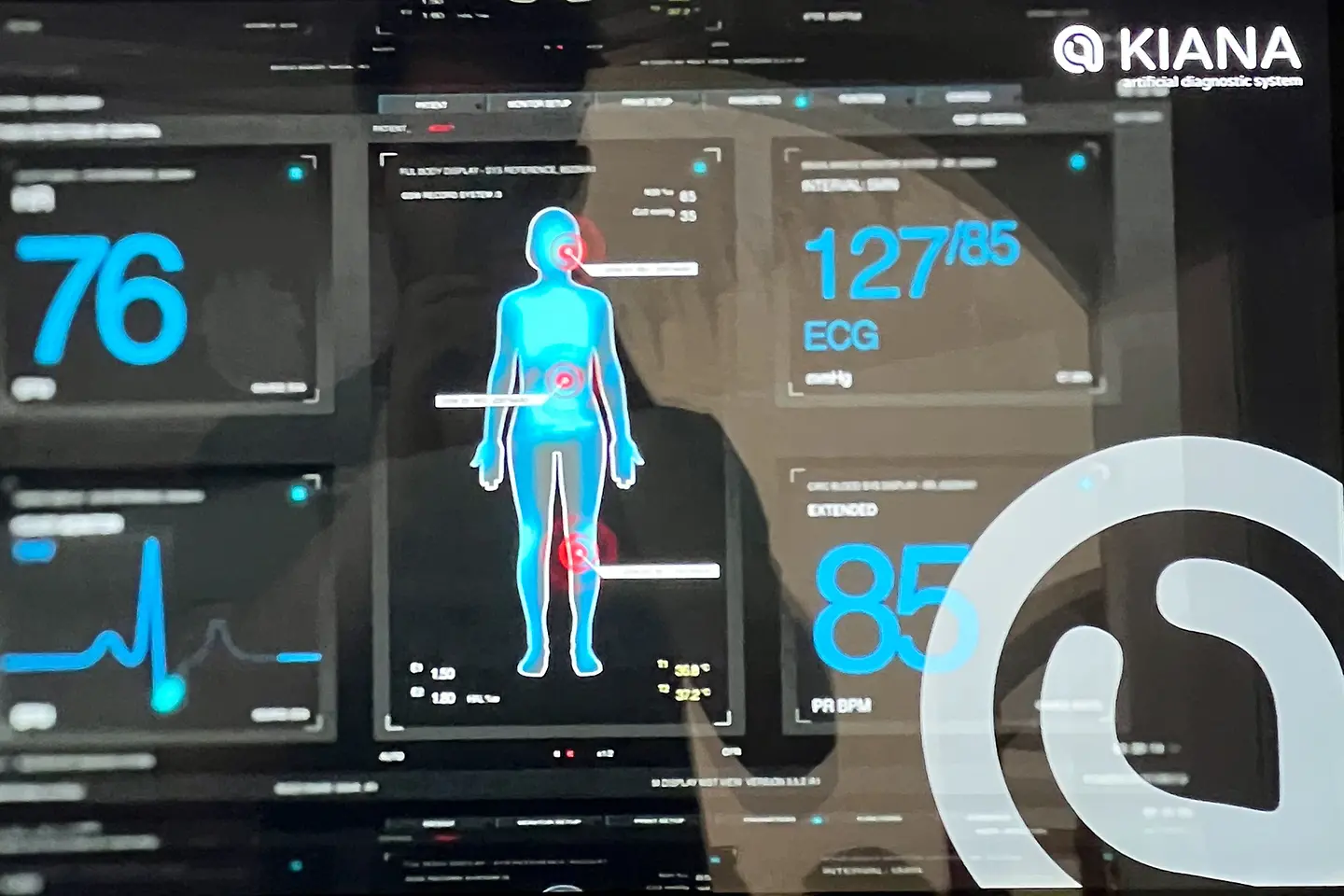 Kiana Screen Abbildung