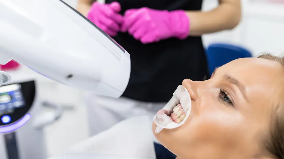 Bleaching So funktioniert die Zahnaufhellung beim Zahnarzt und zu
