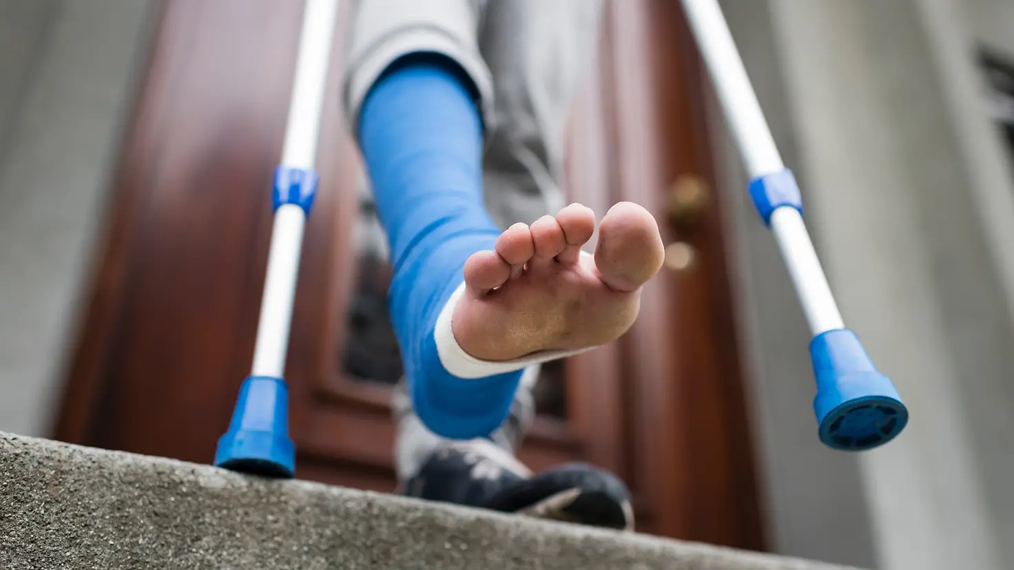 Ein Bein in blauem Verband und Krücken auf eine Treppe