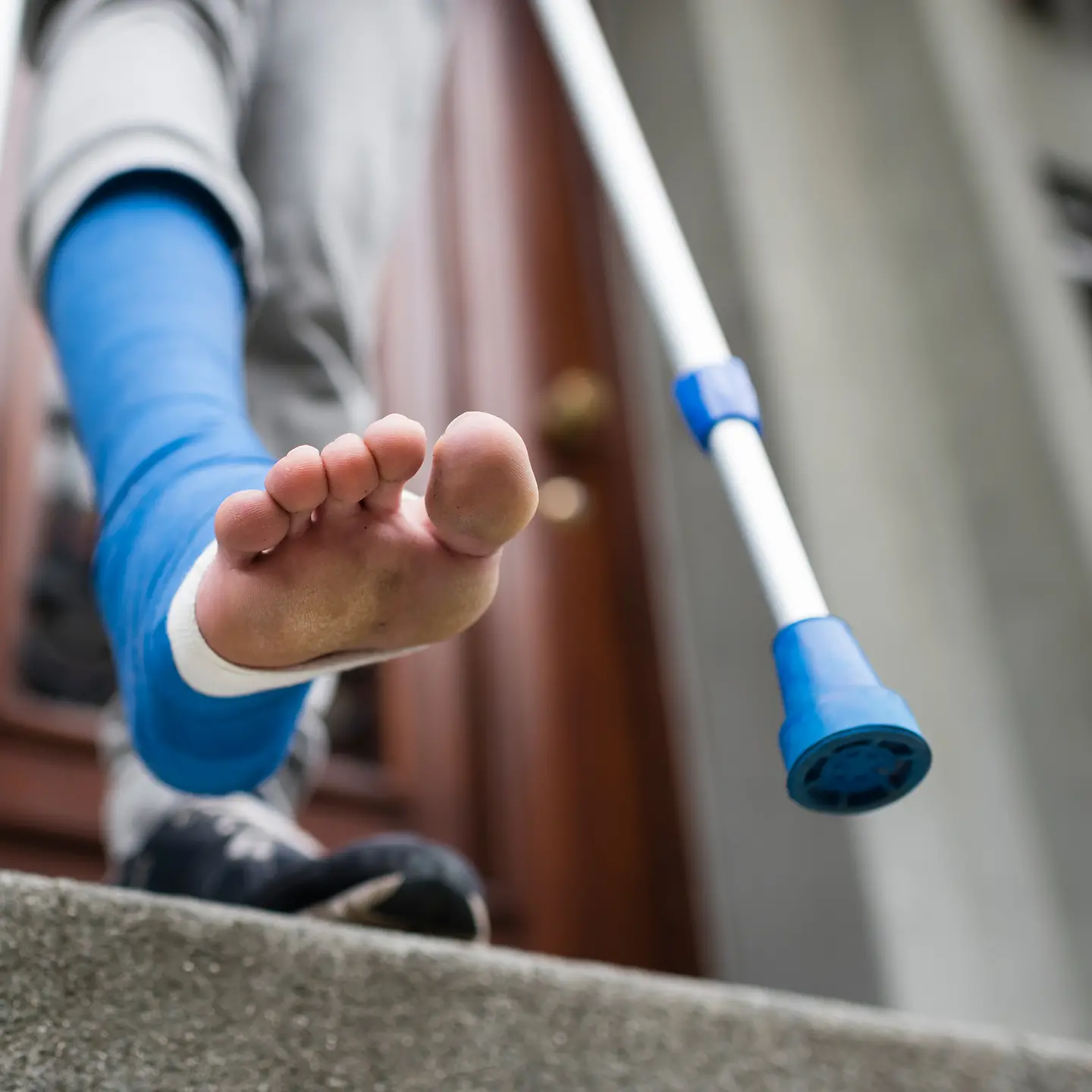 Ein Bein in blauem Verband und Krücken auf eine Treppe