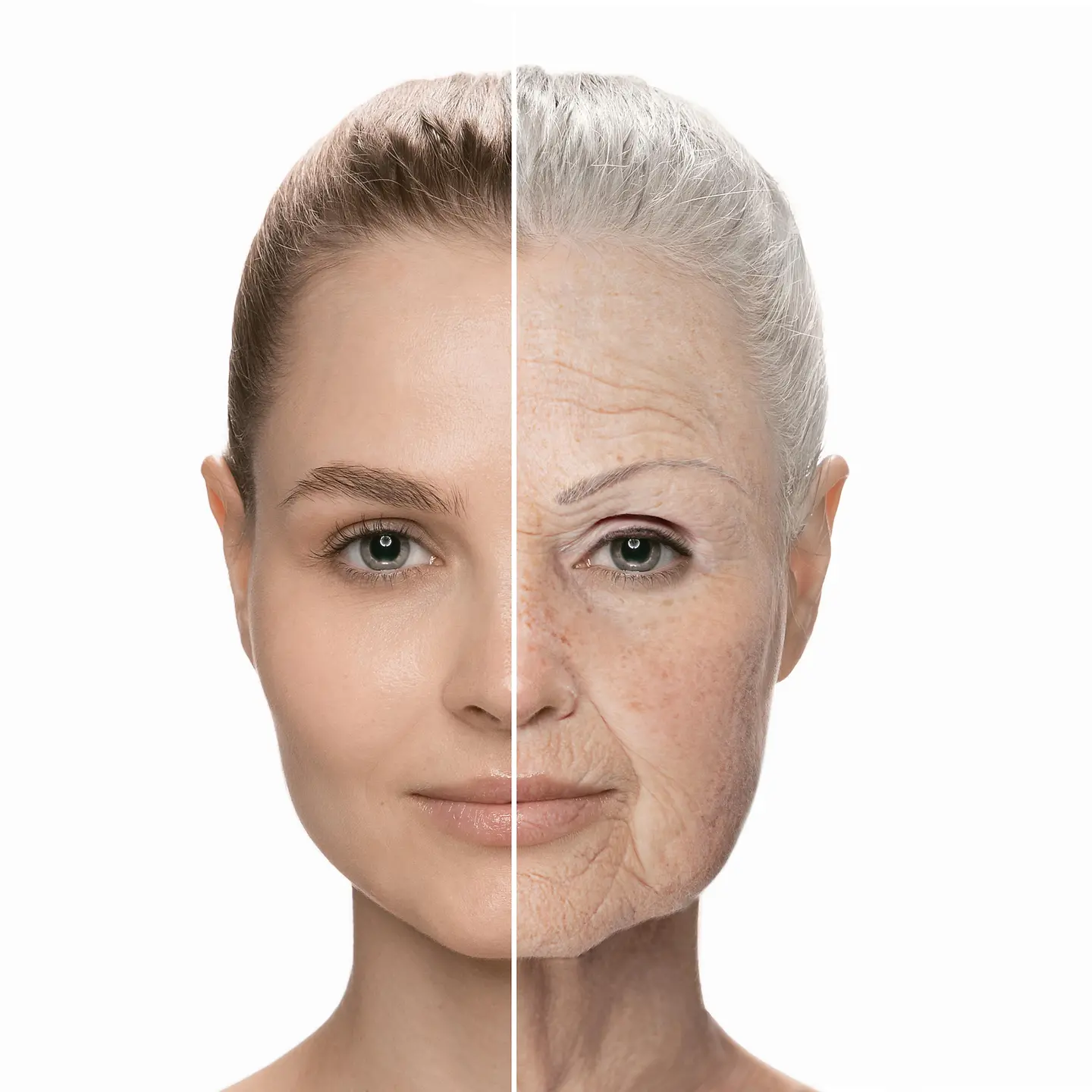 Das Foto zeigt ein Frauengesicht. Es ist ein deutlicher Altersunterschied in den beiden Gesichtshälften zu erkennen. Die linke weist glatte, junge Haut auf und ebenso braunes Haar. Die rechte Hälfte hat Falten und weißes Haar. 